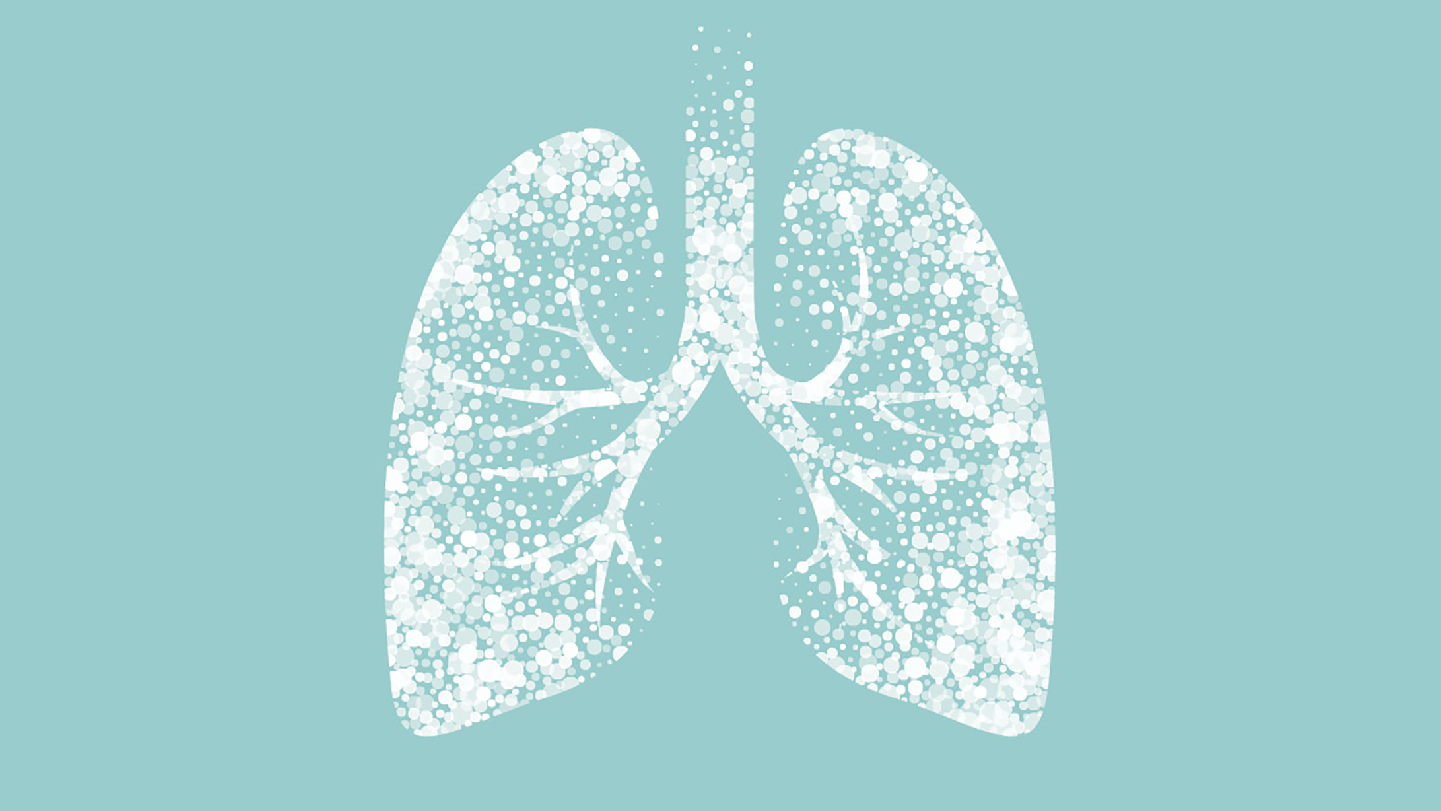 Investigational Treatment Slowed Lung Function Decline In IPF | Press